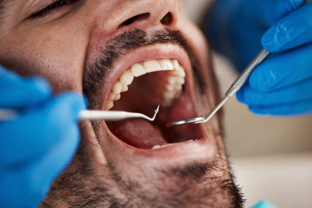 Best Emergency Dental Care for Broken or Chipped Teeth in Waller, TX